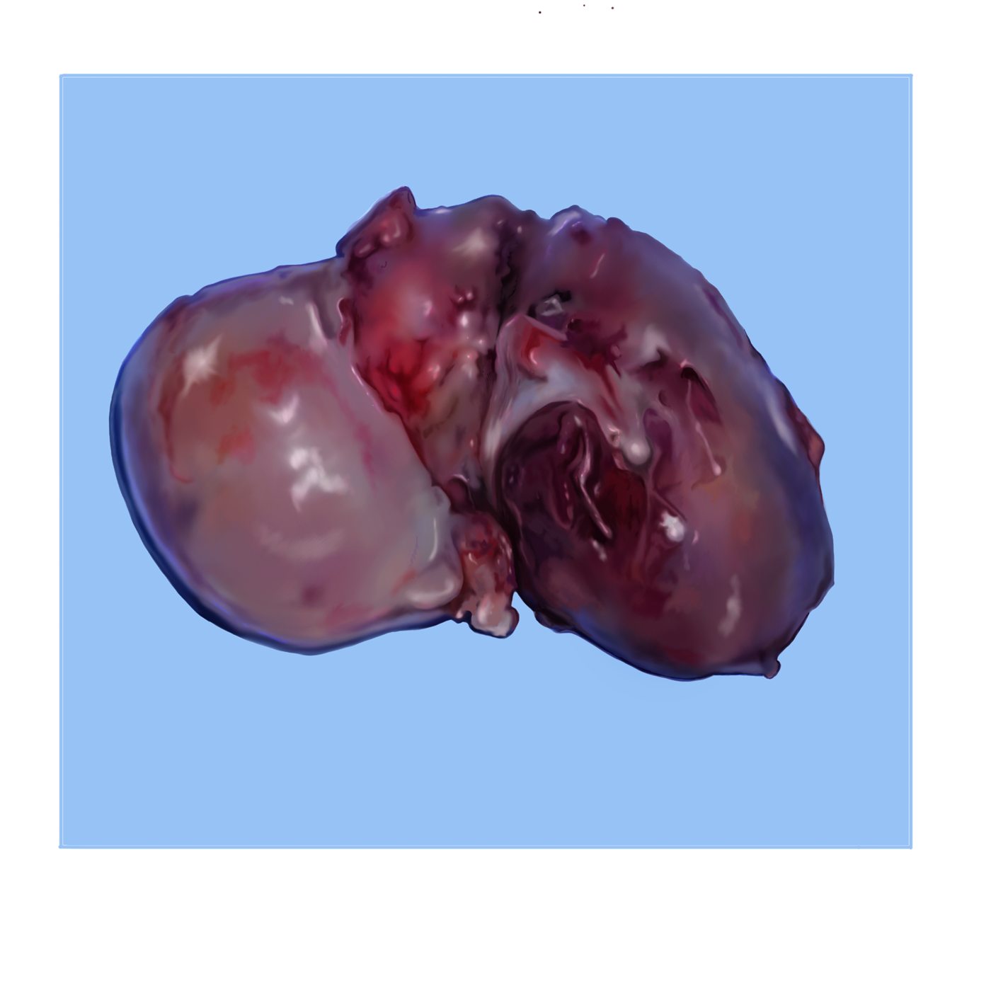 Work-in-progress panel: excised specimen stage