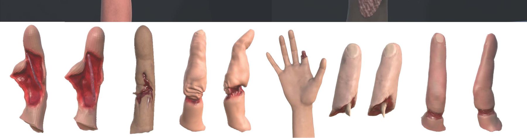 Row of 3D digit models depicting a range of injury and healing states used in the training tool