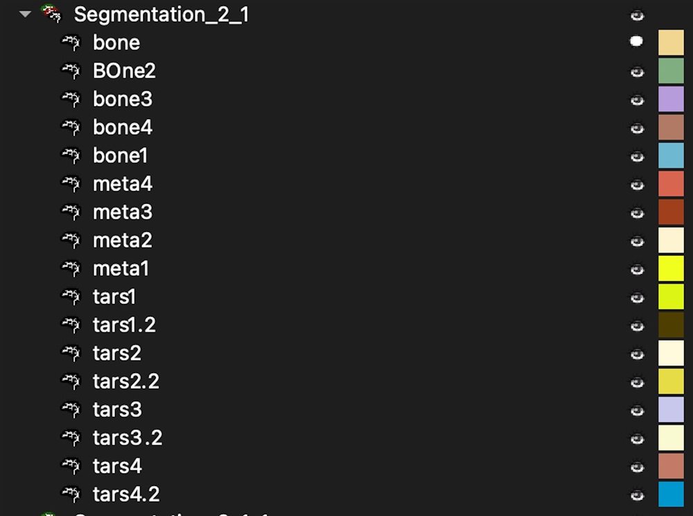 Anatomical bone segmentation naming list