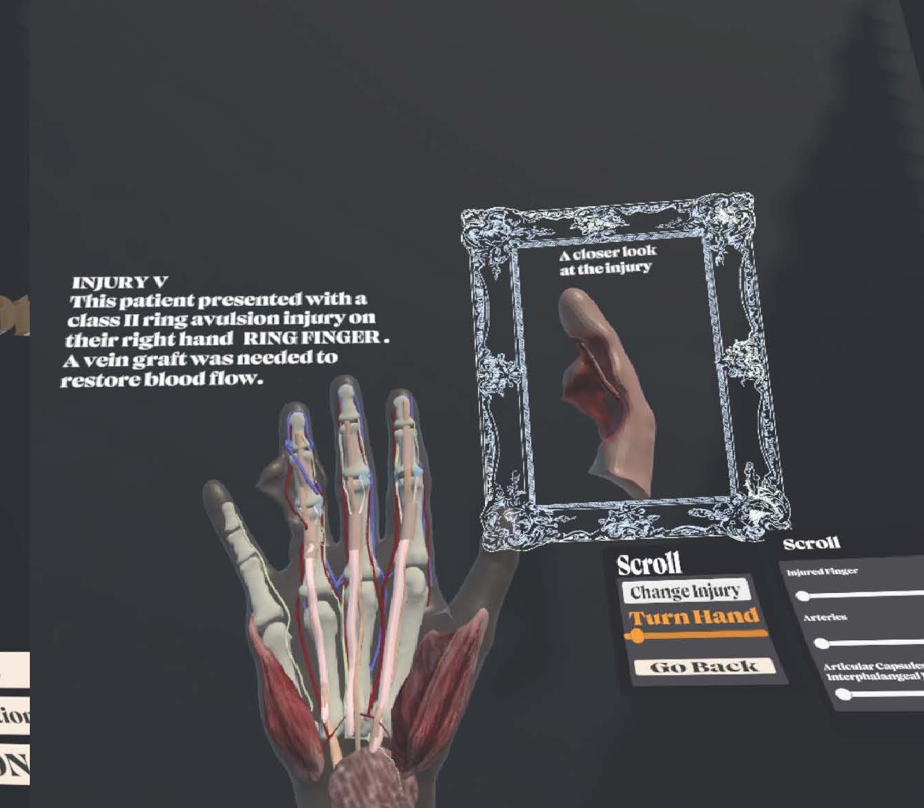 Digit Revascularization VR Training Tool — isolated anatomy view
